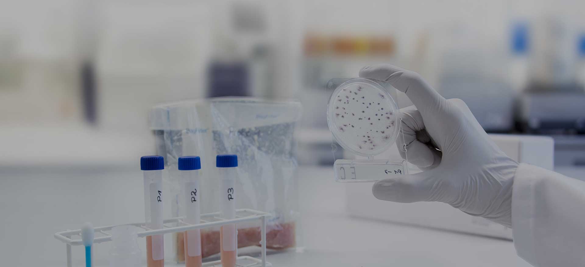 Microbial Testing Kit, Microbiology Sample Test & Lab Kit ELEX Biological