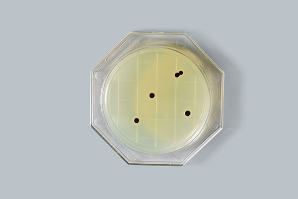 Contact Agar Medium Test