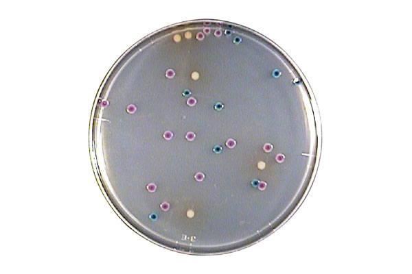 E.coli & Coliforms Chromogenic Medium